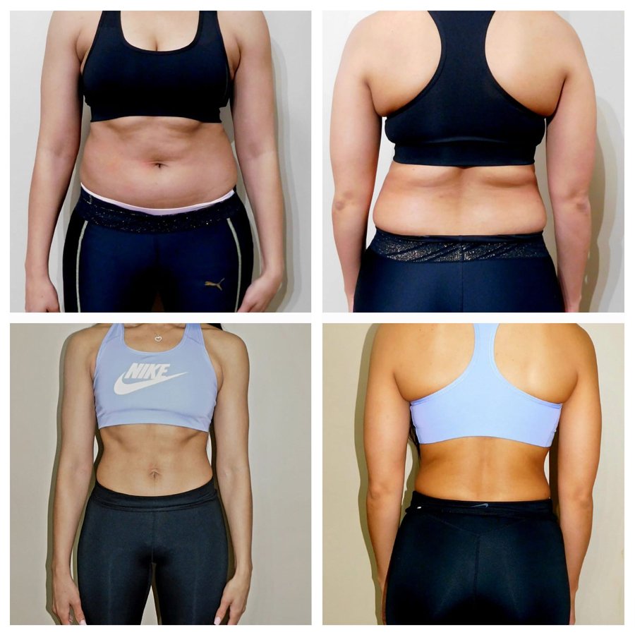 Client 7 — Front & Back Progress